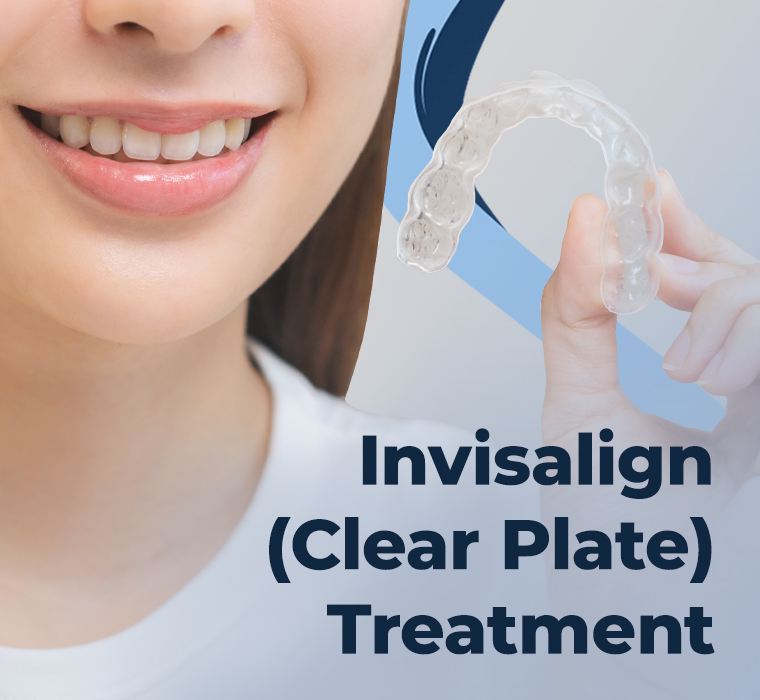 Invisalign